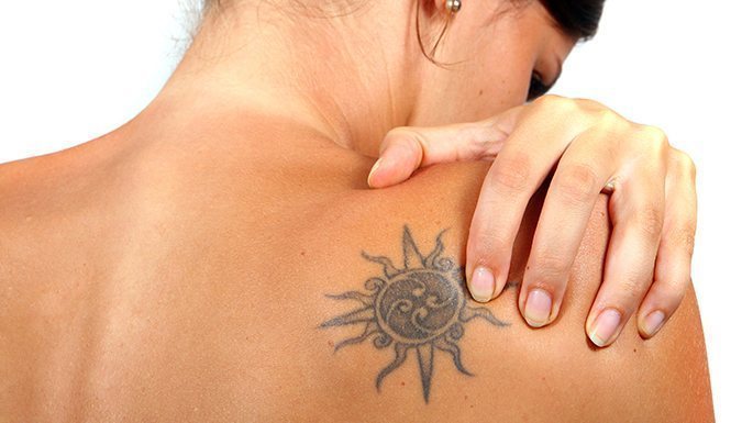 Laser Tatoo Removal Cost
