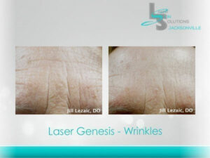 Wrinkles Before After Jacksonville FL