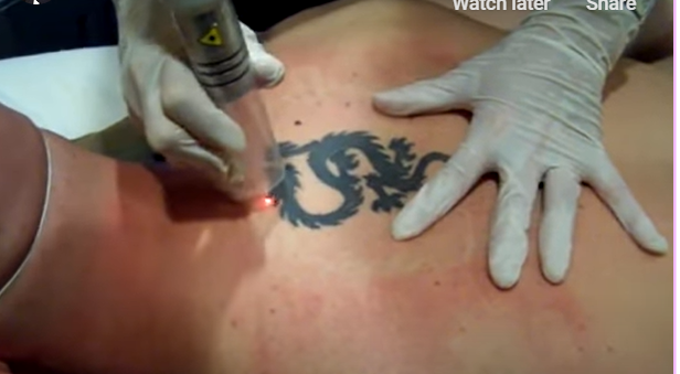 Dr. Jill Lezaic Palm Beach Laser Tattoo Removal Specialist